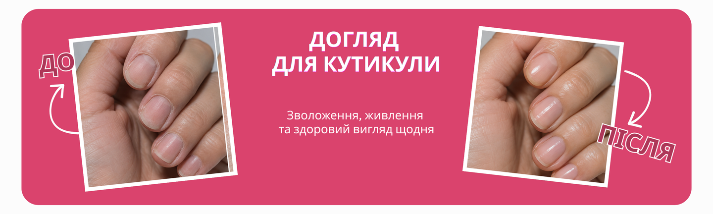 Banner cuticle